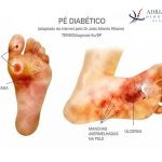 Cuidados com os pés em pessoas com diabetes
